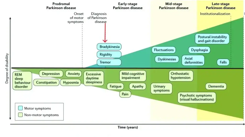 parkinsons before diagnosis